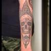 Skull healed